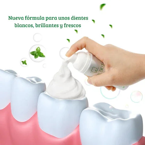 SmileKit® - Espuma blanqueadora Dental