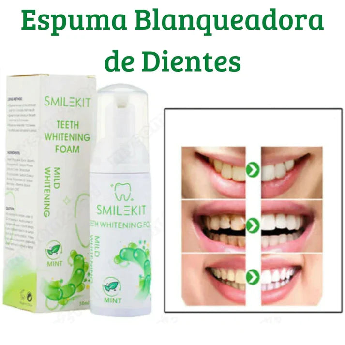 SmileKit® - Espuma blanqueadora Dental